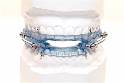 Particuliere parameters Standaardtest voor mondhygiëneapparaten: GB 4706.59-2008